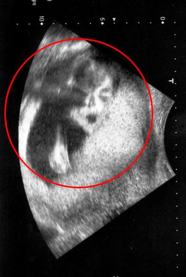 Ŀ�ɿڴ� �и�B����Ƭ�ָ����ܿ�ѷӰ��