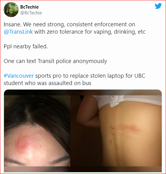 亚裔女大学生公车上遭4白人围殴 高声呼救无人应