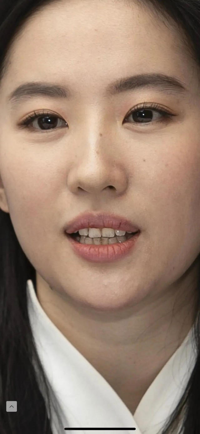 刘亦菲高清生图幻灭 脸上斑点明显牙垢发黑