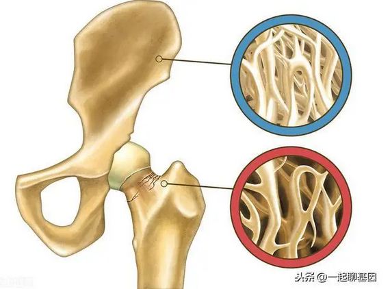 防治骨质疏松相当于“补钙”？真相是这样的