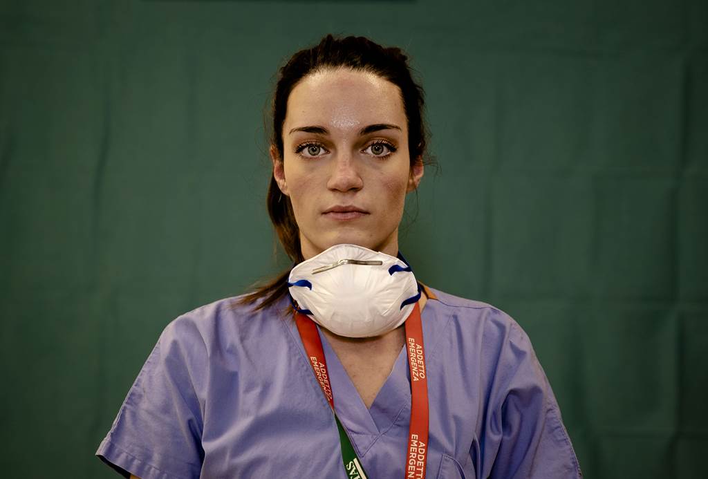一名义大利医护人员在长期戴上口罩后，脸上已留下痕迹。