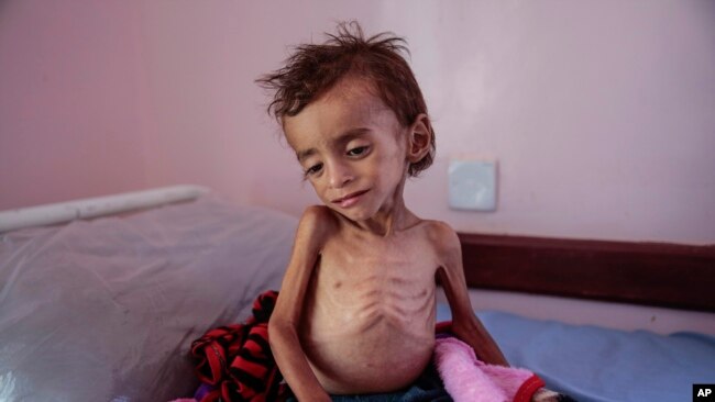 联合国：需要近40亿美元来防止也门大饥荒