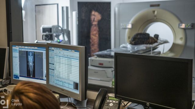 核磁共振扫描和放射学影像技术帮助了这一考古学发现。