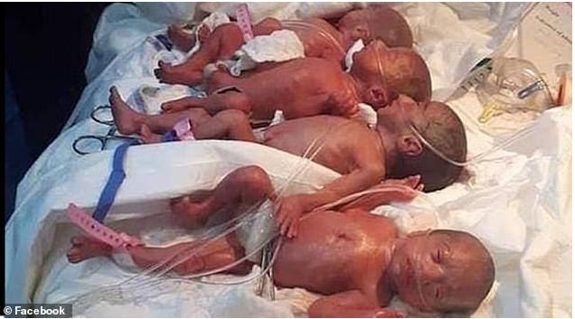 奇迹！25岁妇女产下9胞胎 比产检还多两个…