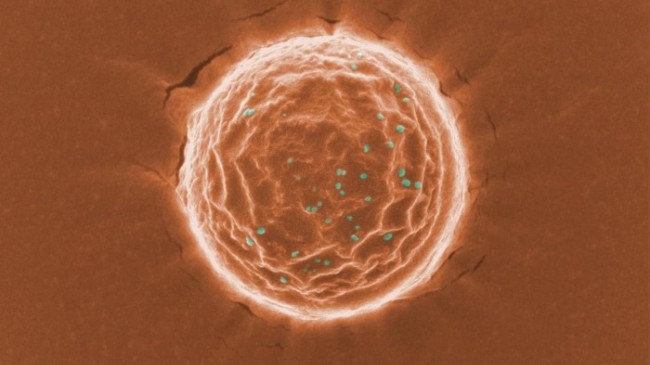 科学家设计"纳米陷阱"来捕捉体内的冠状病毒