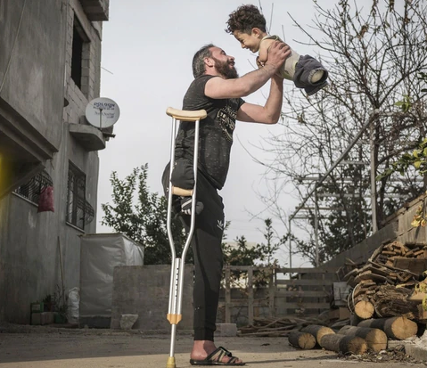 独脚爸与无四肢的孩子 获国际摄影大赛年度照片