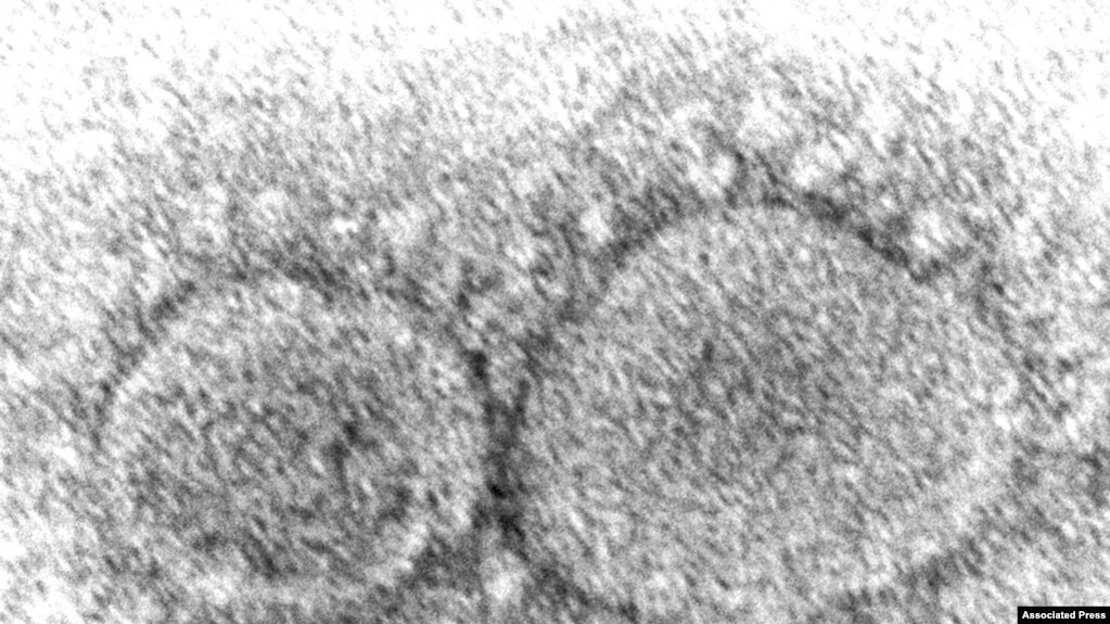 资料照：美国疾病控制与预防中心提供的这张2020年的电子显微镜图像显示了导致COVID-19的SARS-CoV-2病毒颗粒。