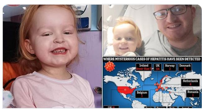 儿童不明肝炎：3岁女童出现一征状后即恶化昏迷