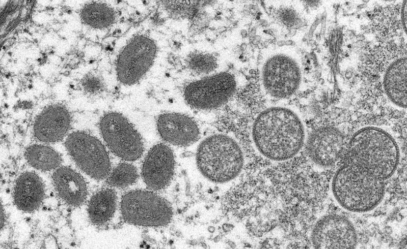 電子顯微鏡下的成熟猴痘病毒粒。(路透)