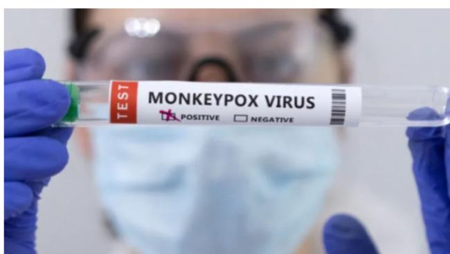 加国猴痘病例暴增 将随时部署天花疫苗