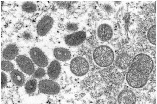 意大利专家研究结果曝光：猴痘感染媒是它