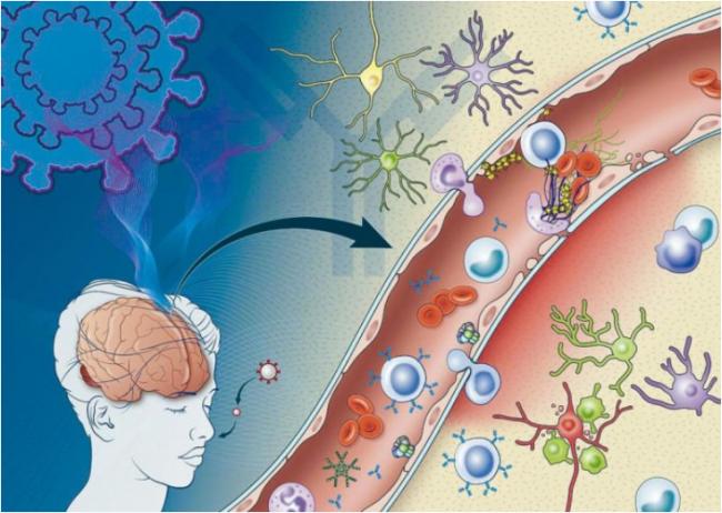 美研究揭“脑雾”秘密 新冠抗体攻击伤脑血管