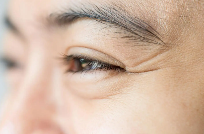眼部的眼角皱纹怎么去除 为你减低肌肤衰老方法
