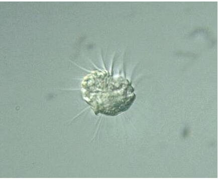 一物克一物： 科学家发现专吃病毒神奇微生物