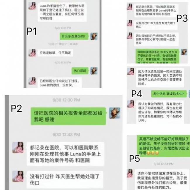 张恒起诉郑爽虐待一双儿女 晒视频曝孩子伤口