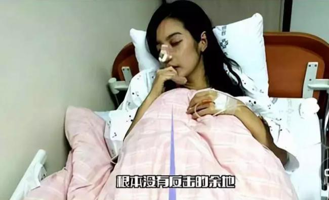 微博疯传林志玲被家暴 照片女主角遭打烂鼻子