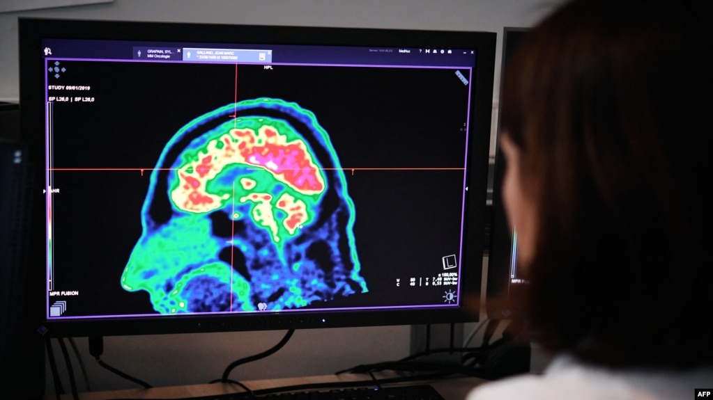 资料照片：2019年1月9日，在法国西部布雷斯特地区和大学医院中心的屏幕上可以看到由正电子发射断层扫描扫仪拍摄的人脑图片。（法新社照片）