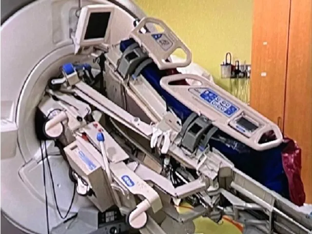 医院MRI设备吞人 护士遭重夹“螺丝贯穿身体”