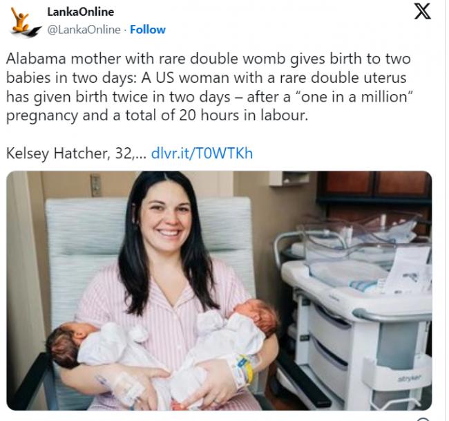 2宝在母体“各住各的” 她“双子宫”产下双胞胎