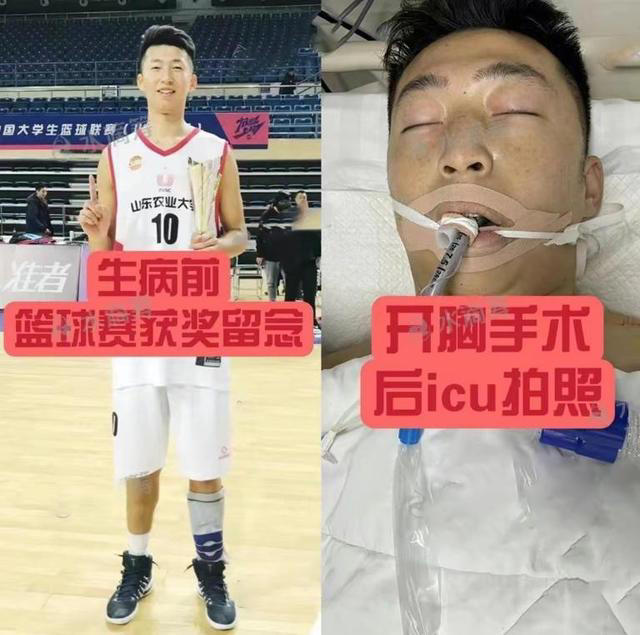 22岁中国一级运动员抢救无效  住院插管照曝光