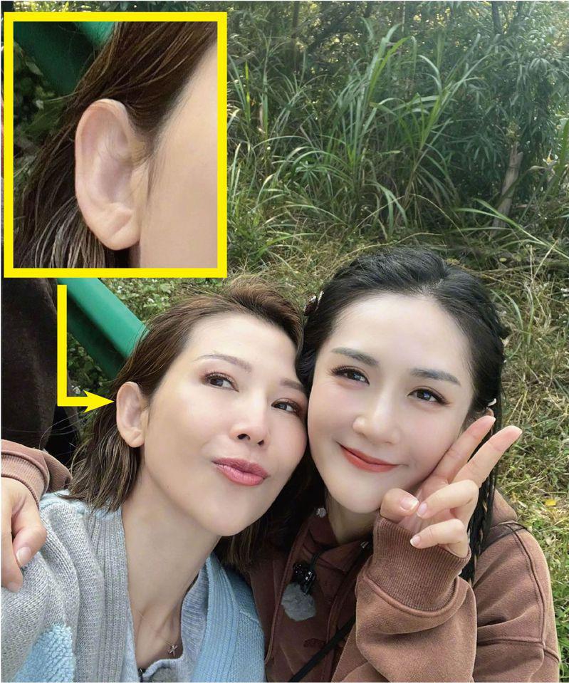 蔡少芬被眼利的网民发现耳垂有明显折纹(左上角)，担心她身体出现问题。(取材自微博)