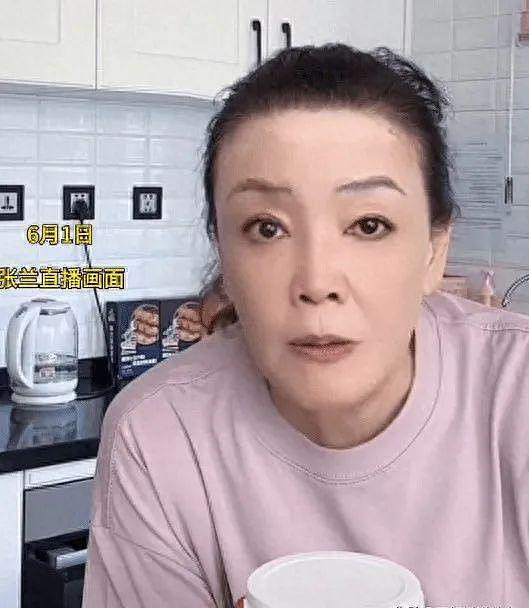 66岁张兰不幸发病 确诊白癜风影响容貌 66岁张兰不幸发病 确诊白癜风影响容貌