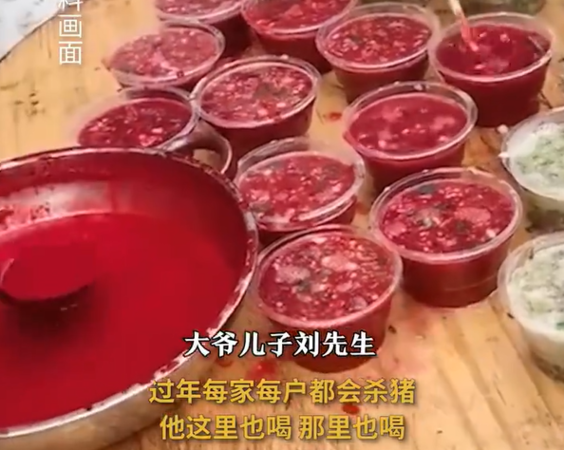 男子爱喝“生猪血”晕倒数次 脑袋爬满寄生虫 男子爱喝“生猪血”晕倒数次 脑袋爬满寄生虫