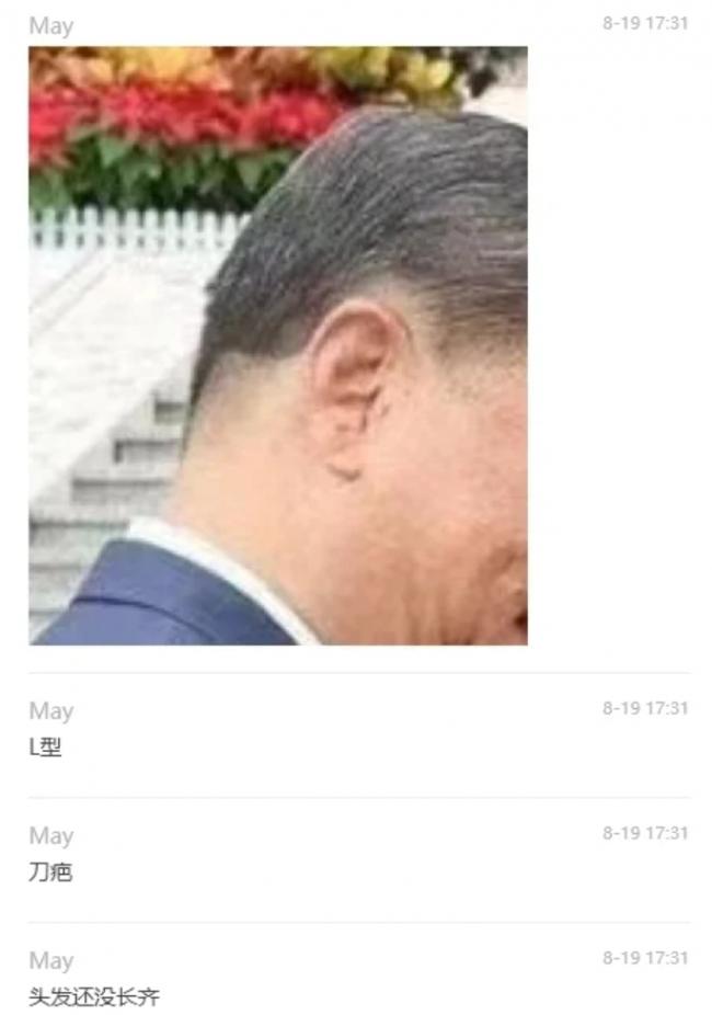 视频泄密 习疑似在俄罗斯犯病 眼与脖子失控