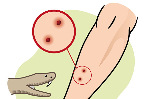 三亚游客疑似被蛇咬伤身亡 蛇咬伤急救“8不要” 三亚游客疑似被蛇咬伤身亡 蛇咬伤急救“8不要”
