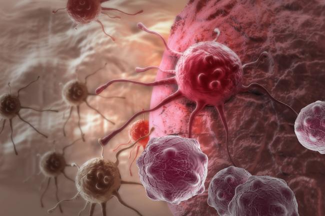 癌症到底有没有先兆?这6个信号早就提醒你了 癌症到底有没有先兆?这6个信号早就提醒你了