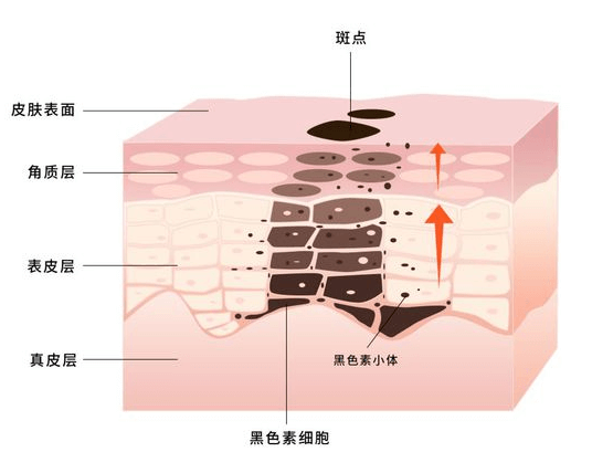 斑点淡化的有效方法 重拾无瑕美肌 斑点淡化的有效方法 重拾无瑕美肌