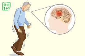 若唇舌出现这6种异常 当心是大病信号 若唇舌出现这6种异常 当心是大病信号