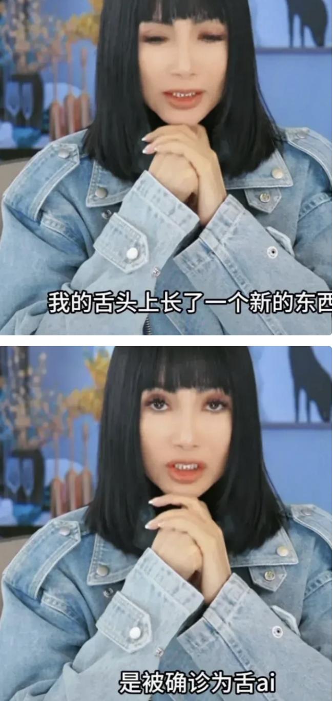 56岁张咪舌癌术后287天重返舞台: 唱歌无歌词只旋律! 三度患癌, 切掉半个舌头 56岁张咪舌癌术后287天重返舞台: 唱歌无歌词只旋律! 三度患癌, 切掉半个舌头