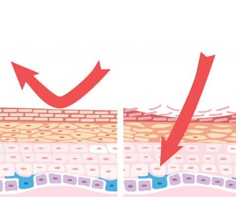 肌底炎症:看不见的肌肤衰老元凶 肌底炎症:看不见的肌肤衰老元凶