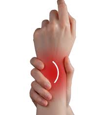 什么是腱鞘炎 以及腱鞘炎的治疗 什么是腱鞘炎 以及腱鞘炎的治疗