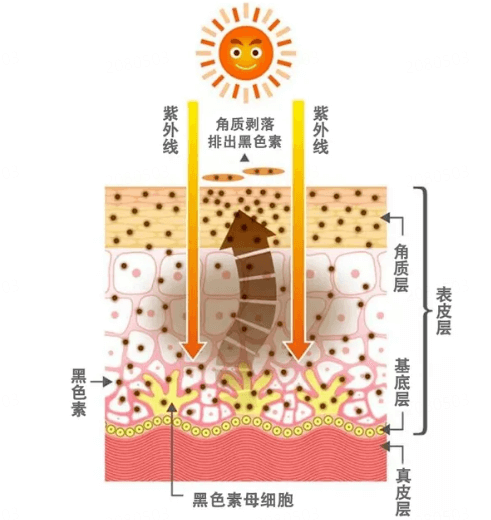 皮肤为何总是起皮?分析角质层缺水与屏障受损 皮肤为何总是起皮?分析角质层缺水与屏障受损
