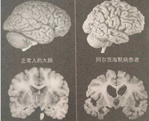 ˵4仰ˣմͬ