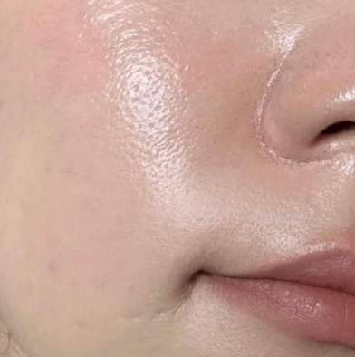 为什么你越控油 皮肤反而越油? 为什么你越控油 皮肤反而越油?