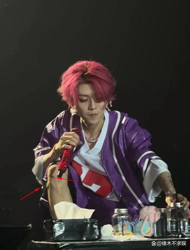 曝鹿晗膝盖伤势严重 已在日本安排手术 曝鹿晗膝盖伤势严重 已在日本安排手术