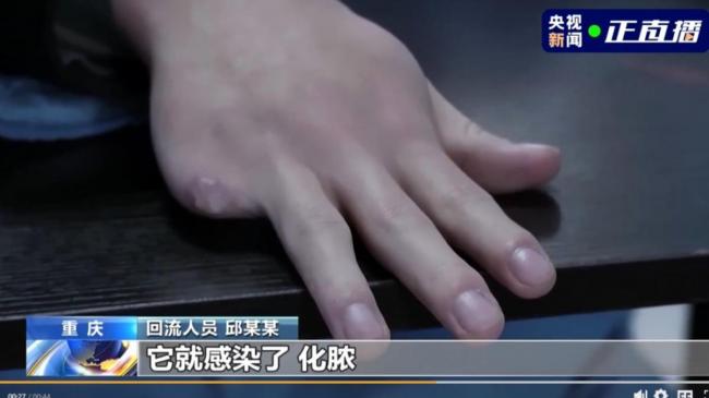 中国抓获徐老发 不服从管理者遭剁手指 中国抓获徐老发 不服从管理者遭剁手指