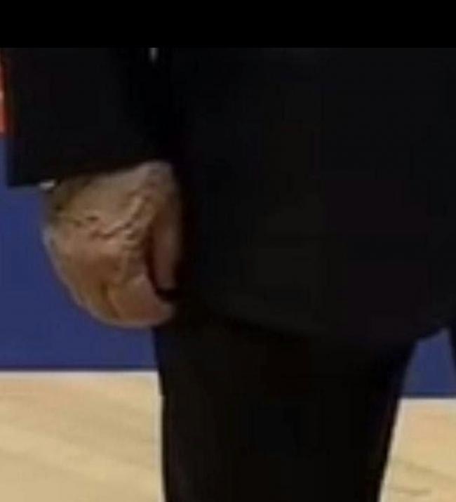 普京“右手”掀热议 再传健康亮红灯 疑患这病