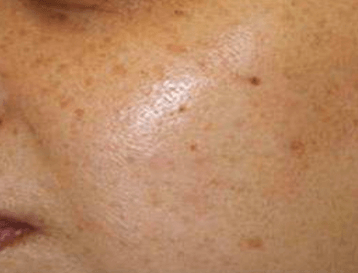 干皮暗黄别乱养 3招养出透亮水光肌 干皮暗黄别乱养 3招养出透亮水光肌