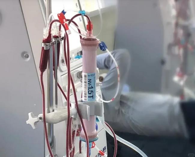 武汉男网购进口补品变肾衰 医生一看大吃一惊 武汉男网购进口补品变肾衰 医生一看大吃一惊