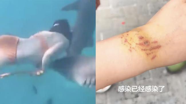 中国女游客生理期潜水  惨遭鲨鱼咬伤