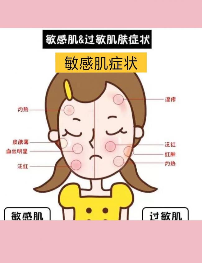 别把敏感当过敏!敏感肌6大症状 早识别早护理 别把敏感当过敏!敏感肌6大症状 早识别早护理
