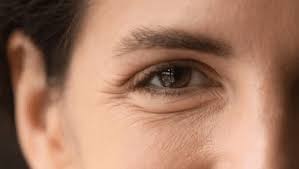 干皮救星!干纹细纹+色素沉着一并击退 干皮救星!干纹细纹+色素沉着一并击退