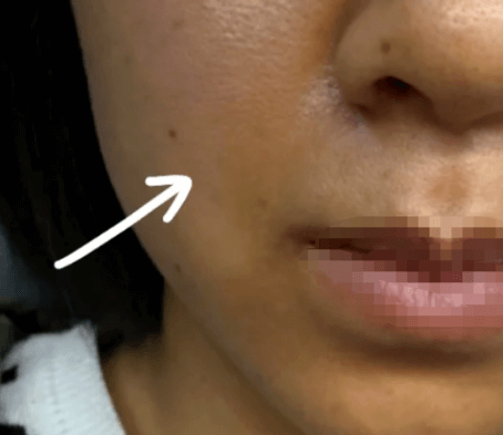 肤色暗沉别乱敷面膜 这6大根源才是“黄气元凶” 肤色暗沉别乱敷面膜 这6大根源才是“黄气元凶”