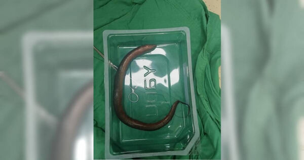 30cm���㸹ǻ������ �����м������Ⱦ���