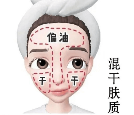 T区油、两颊干还脱皮?这样应对不翻车 T区油、两颊干还脱皮?这样应对不翻车
