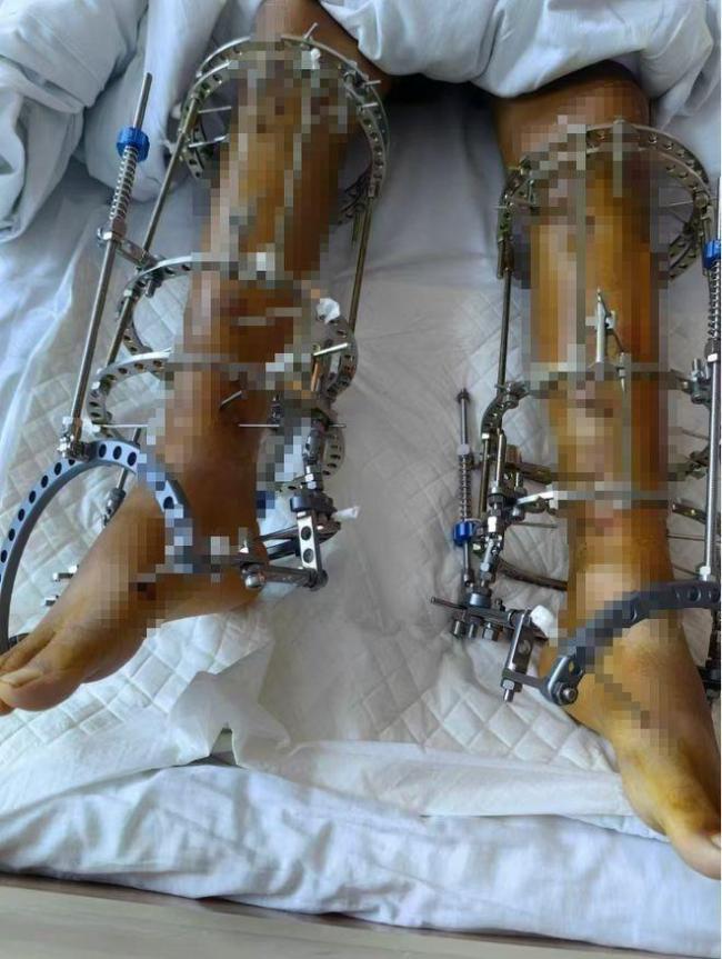 ���ы������� 20�qŮ����������g 10����̫�K